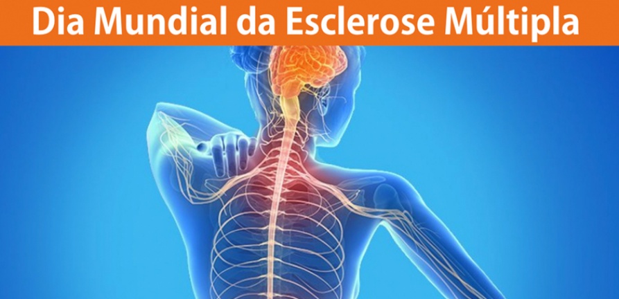 Você está visualizando atualmente Dia Mundial da Esclerose Múltipla – 30 de Maio