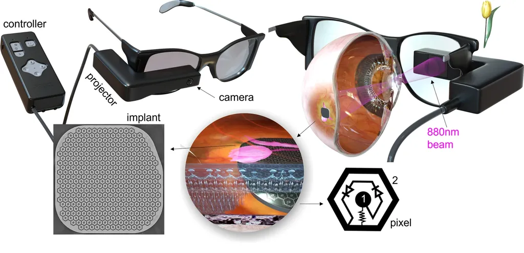 Você está visualizando atualmente EUA: Óculos especiais restauram visão de pacientes com degeneração macular