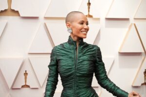 Leia mais sobre o artigo Jada Smith e a alopecia; entenda o que é a doença