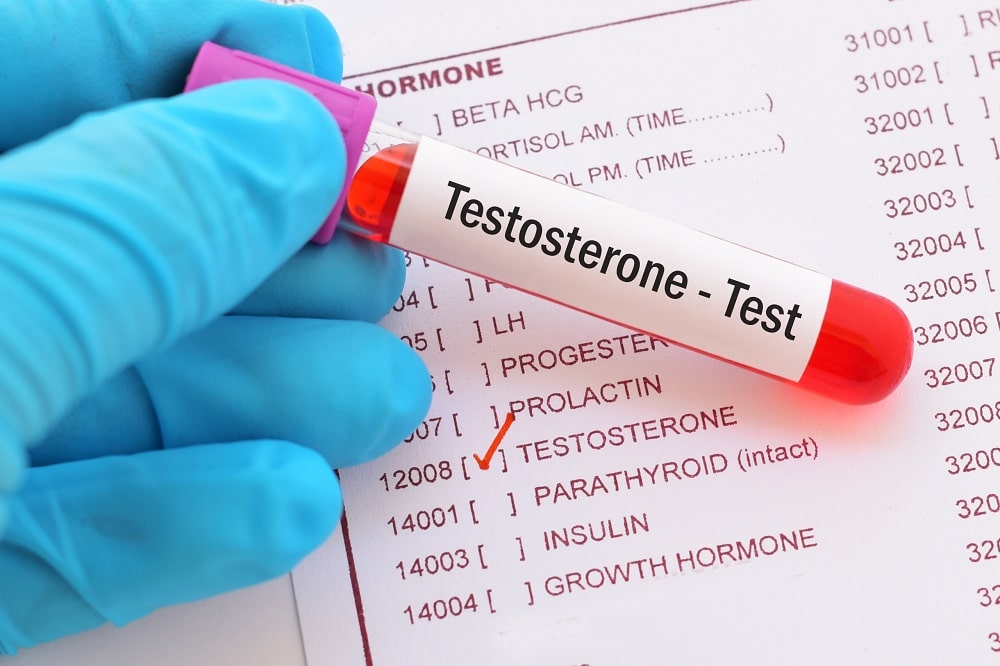 No momento, você está visualizando Casos graves de covid podem ter ligação com nível de testosterona