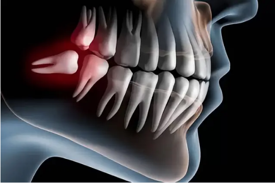 Você está visualizando atualmente Cientistas desenvolvem remédio que faz dentes renascerem