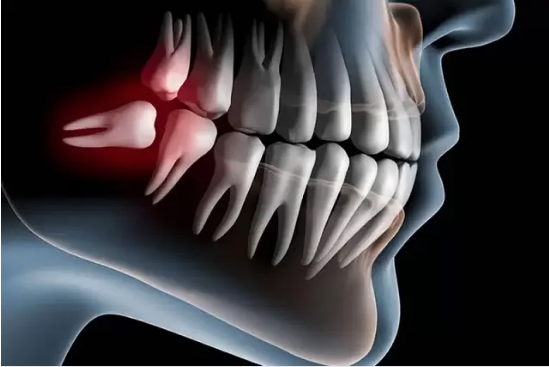 No momento, você está visualizando Cientistas desenvolvem remédio que faz dentes renascerem