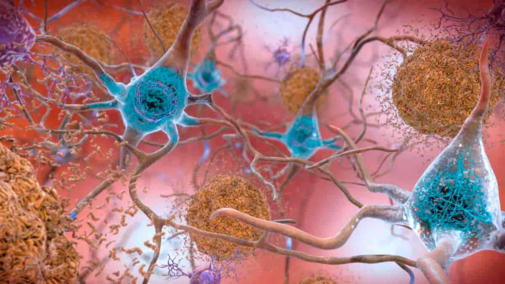 Você está visualizando atualmente Células nervosas do cérebro podem conduzir movimento corporal