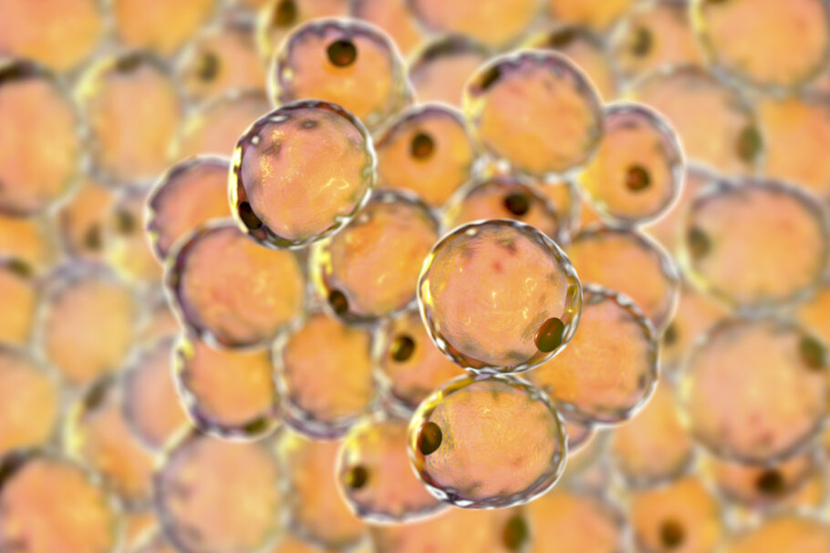 Você está visualizando atualmente Estudo descobre o que aumenta colesterol mesmo com dieta saudável