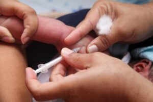 Leia mais sobre o artigo Vacina BCG passa a ser aplicada em mais 4 UBSs de Cuiabá