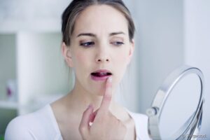 Leia mais sobre o artigo AUTOEXAME: Conheça 6 passos para identificar sinais de câncer bucal