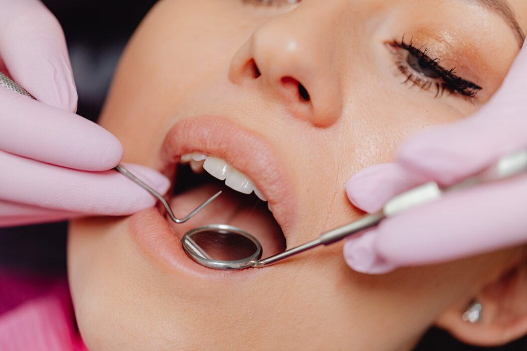 Você está visualizando atualmente Alesp segue norma da Anvisa e proíbe uso de amálgama de mercúrio na odontologia