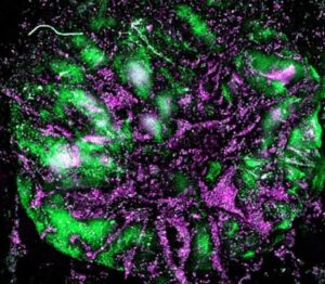 Leia mais sobre o artigo Cientistas criam sistema imunológico em miniatura para estudar câncer