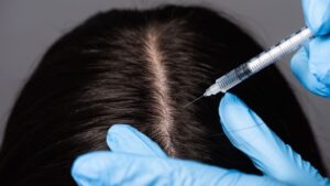 Leia mais sobre o artigo Nova proteína que auxilia no crescimento capilar é descoberta pela ciência