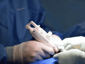 Leia mais sobre o artigo Fim da vasectomia? Startup testa anticoncepcional para homens