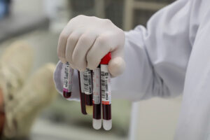 Leia mais sobre o artigo Sangue criado em laboratório pode suprir falta de doadores