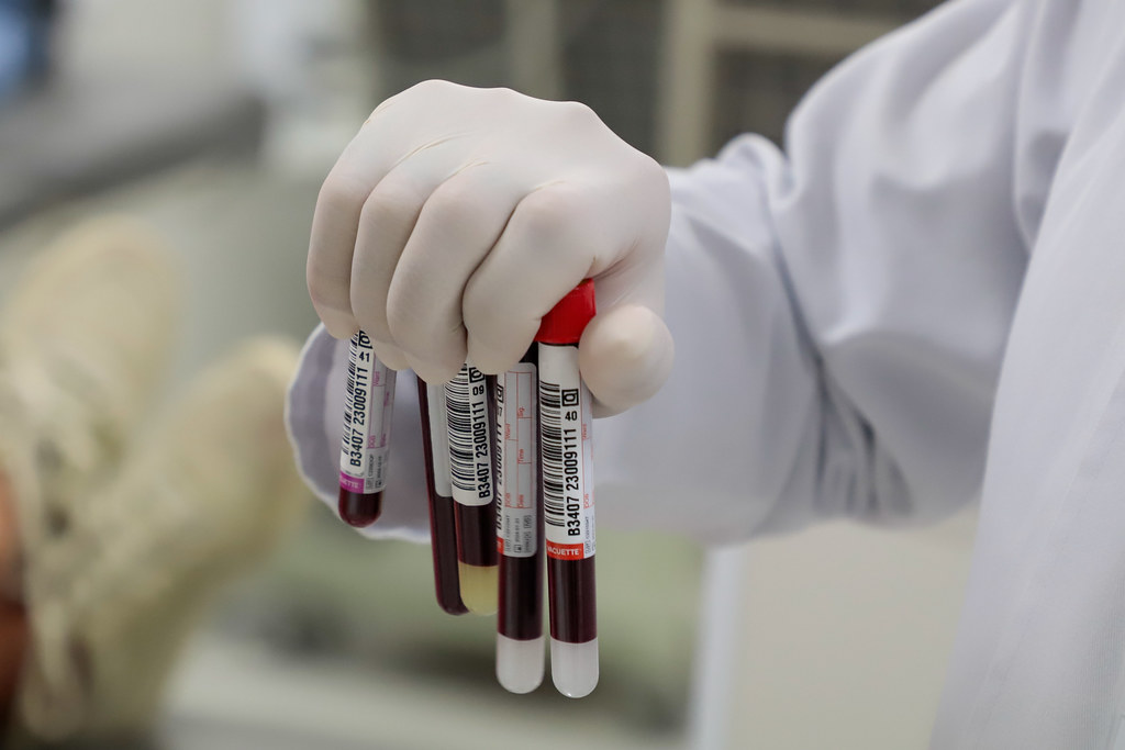 No momento, você está visualizando Sangue criado em laboratório pode suprir falta de doadores