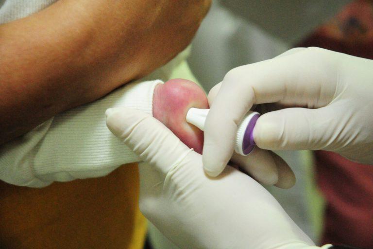 No momento, você está visualizando MT Hemocentro atende 599 pacientes com a doença falciforme