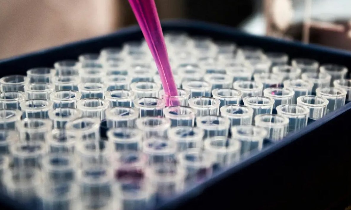 No momento, você está visualizando Estudo mostra que inflamação no cérebro pode ser chave do Alzheimer