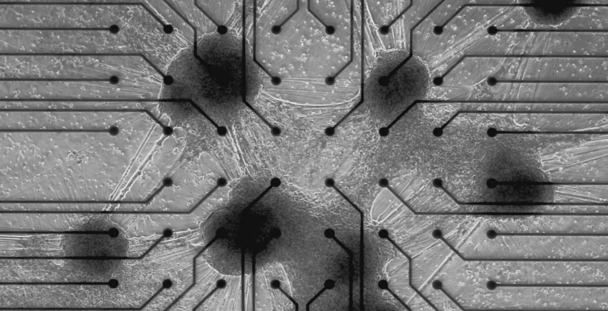 No momento, você está visualizando Startup constrói ‘data center vivos’ com neurônios humanos