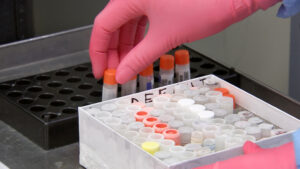 Leia mais sobre o artigo EBOLA: Reino Unido inicia testes em humanos de vacina